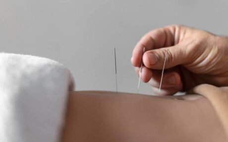 Acupuncture Level 3 Advanced Diploma