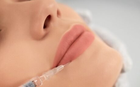 Lip Filler Level 3 Advanced Diploma